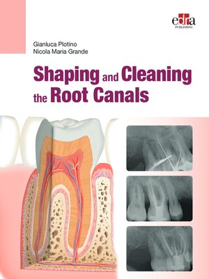 cover image of Shaping and  Cleaning the Root Canals